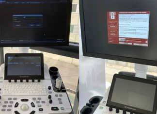 Researchers Uncover 11 Security Flaws in GE HealthCare Ultrasound Machines